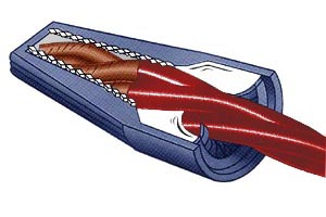 Cut-away view